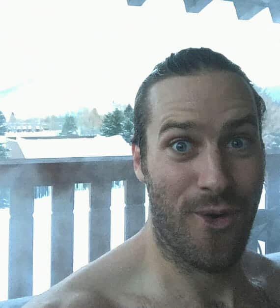 Armie Hammer